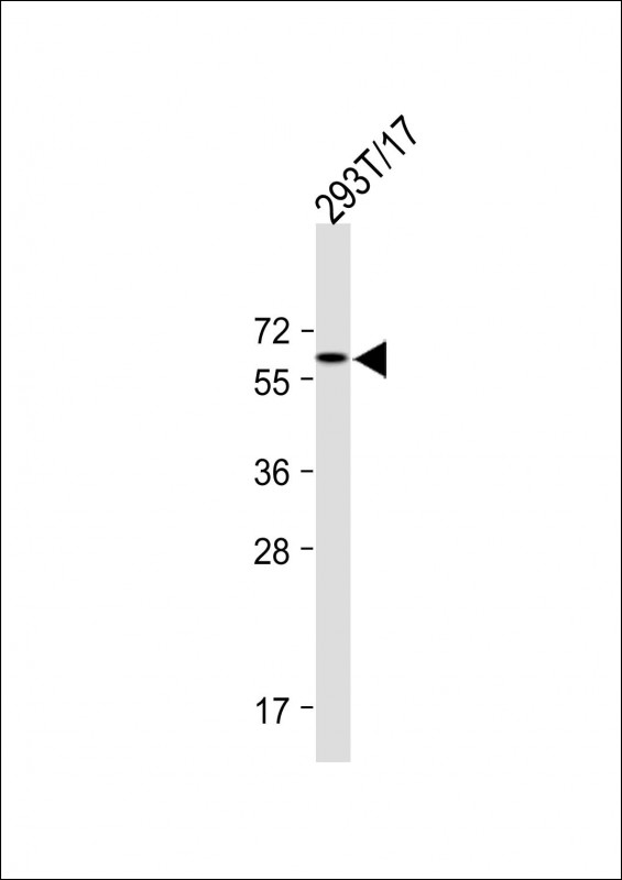 1 - FOXG1 Antibody (Center) AP9793C