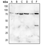 1 - Anti-SGLT2 Antibody AP53701