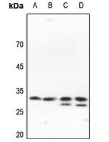 1 - Anti-SLC25A11 Antibody AP53711