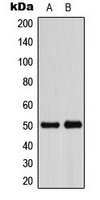 1 - Anti-ADPGK Antibody AP53786