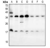 1 - Anti-LY6E Antibody AP53855