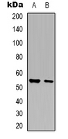 1 - Anti-Glycerate Kinase Antibody AP53912