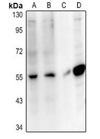 1 - Anti-SLC10A4 Antibody AP54105
