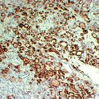 2 - Anti-Thyroid Peroxidase Antibody AP54139