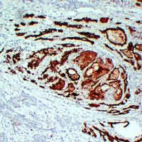 3 - Anti-Thyroid Peroxidase Antibody AP54139