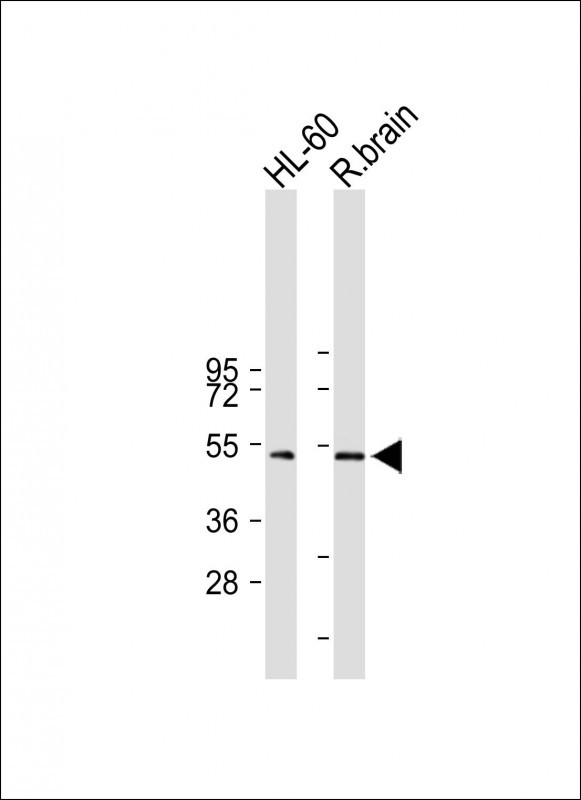 1 - GIPR Antibody (N-term) AP7495A