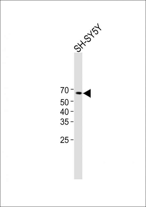 1 - BACE Antibody (S498) AP7774a