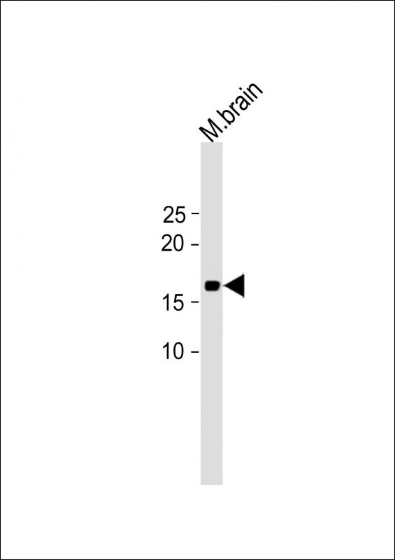 1 - HIST3H2A Antibody (N-term) AP21623a