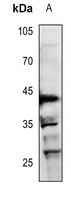 1 - Anti-RUNX3 Antibody AP59501