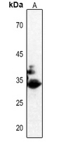 1 - Anti-CDK2 (pT160) Antibody AP59509