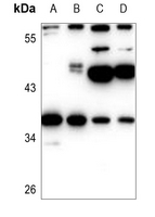 1 - Anti-EIF2S1 Antibody AP59544