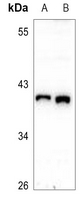 1 - Anti-HSP40 Antibody AP59583