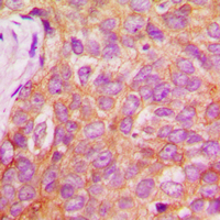 2 - Anti-IRS1 (pS1101) Antibody AP59592