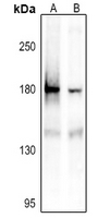 1 - Anti-IRS1 (pS1101) Antibody AP59592