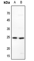 1 - Anti-MAD2 Antibody AP59612