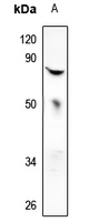 1 - Anti-MX2 Antibody AP59628