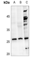 1 - Anti-NDUFV2 Antibody AP59633