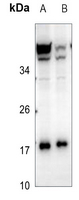 1 - Anti-RKIP Antibody AP59648