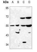 1 - Anti-PAH Antibody AP59649