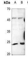 1 - Anti-Trypsin 1 Antibody AP59678