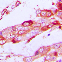 2 - Anti-SSBP1 Antibody AP59708