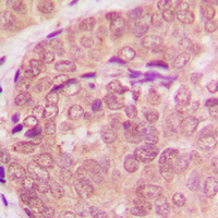 2 - Anti-STAT6 Antibody AP59710