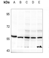 1 - Anti-DOK2 (pY299) Antibody AP59764