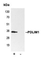 5 - Anti-PDLIM1 Antibody AP59768