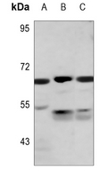 1 - Anti-PKLR Antibody AP59931
