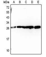 1 - Anti-RAB14 Antibody AP59951
