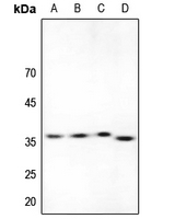 1 - Anti-ACER1 Antibody AP59956