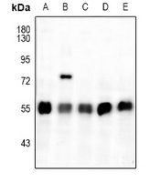1 - Anti-ATF4 (pS245) Antibody AP59971