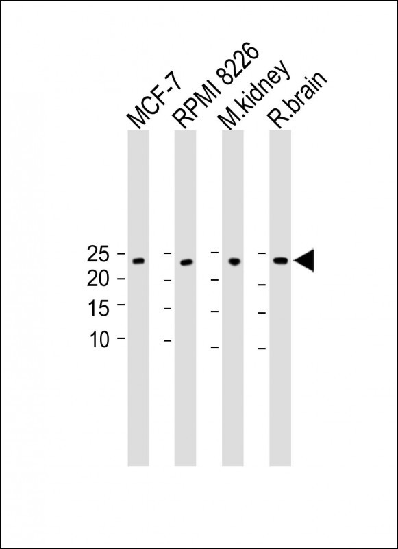 1 - C9orf95 Antibody (N-term) AP9650a
