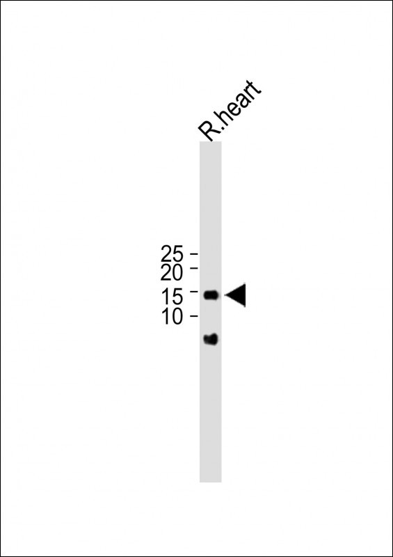 1 - ISCA2 Antibody (Center) AP10491c