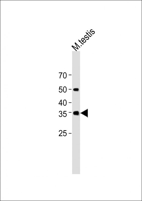 1 - KLRC1 Antibody (N-term) AP12570a