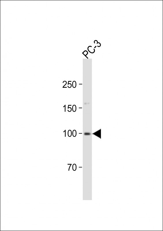1 - MAP4K3 Antibody AP9860A