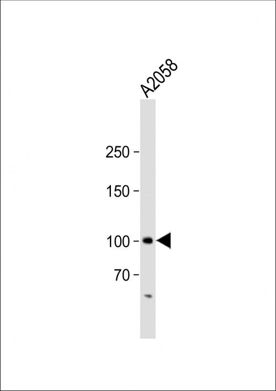 1 - MAP4K3 Antibody AM1903b