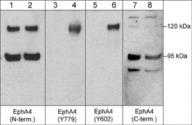 1 - Anti-EphA4 (N-terminal region) Antibody AN1778