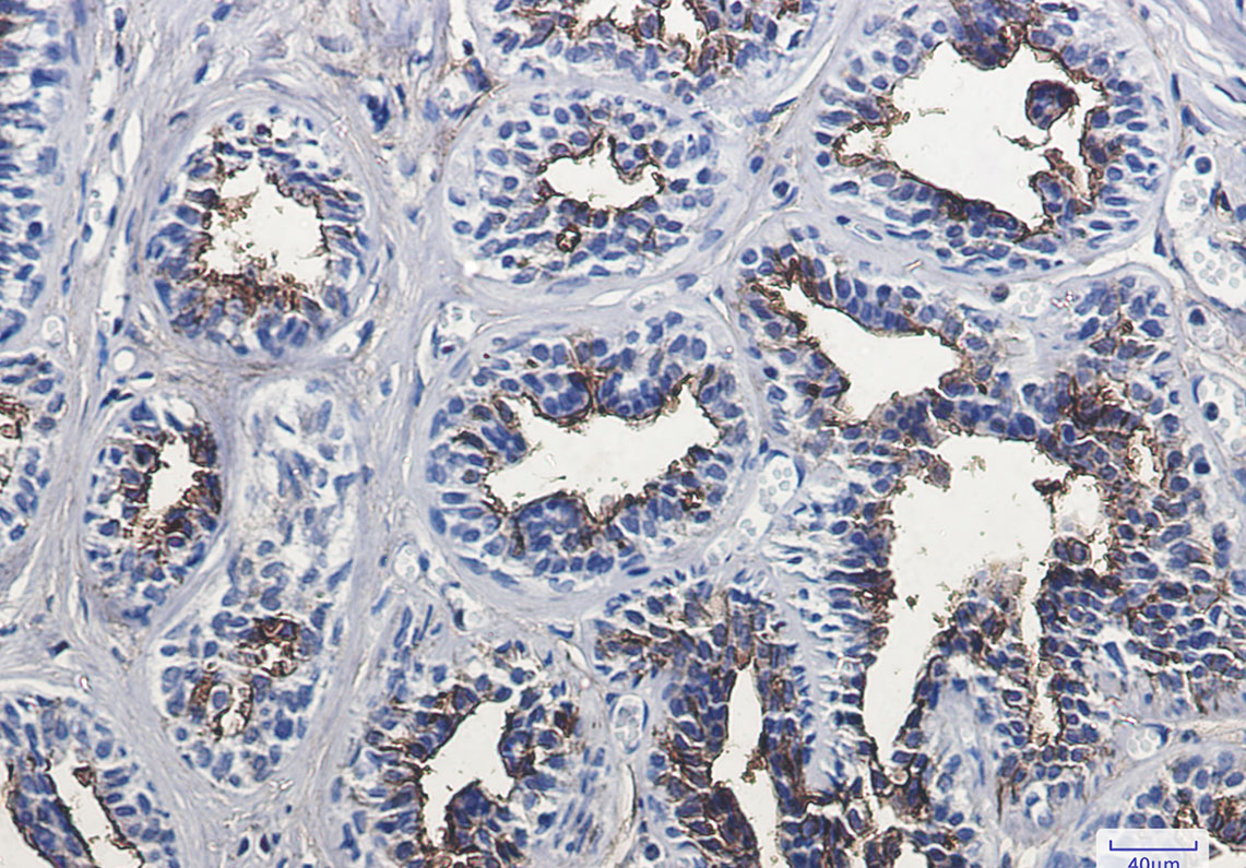 3 - CD13 Rabbit mAb AP74875