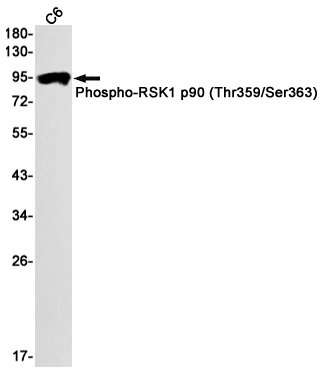 5 - Phospho-RSK1 p90 (Thr359/Ser363) Rabbit mAb AP74971