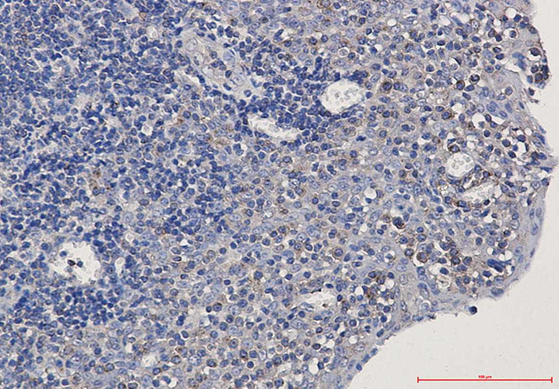 3 - alpha Tubulin Rabbit mAb AP75064
