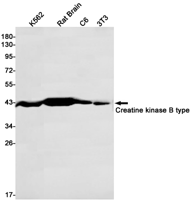 2 - Creatine Kinase B type Rabbit mAb AP75288