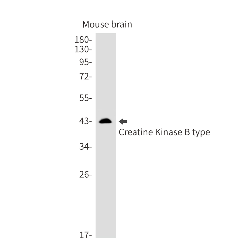 1 - Creatine Kinase B type Rabbit mAb AP75289