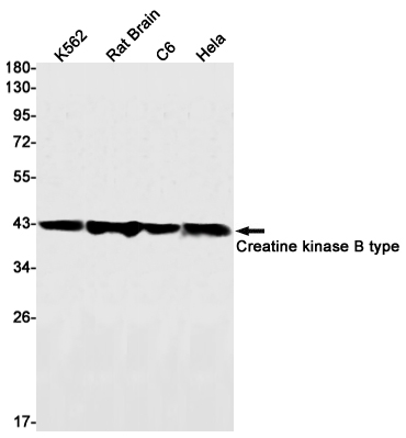 2 - Creatine Kinase B type Rabbit mAb AP75289