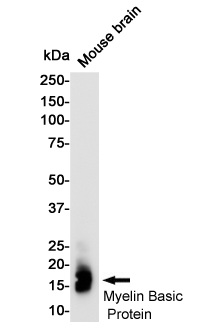 1 - Myelin Basic Protein Rabbit mAb AP75760