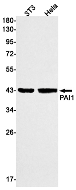 1 - PAI1 Rabbit mAb AP75863