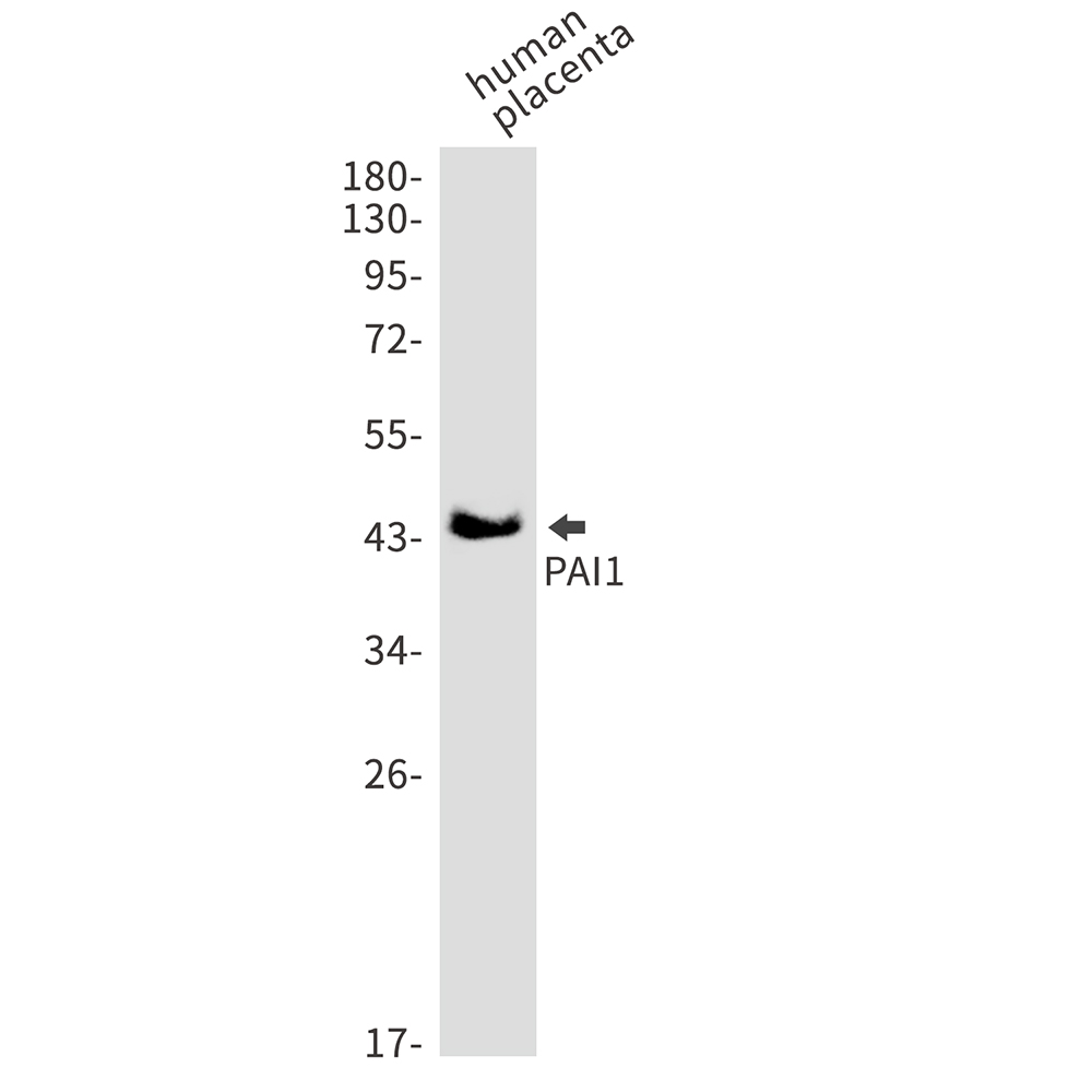 1 - PAI1 Rabbit mAb AP75864