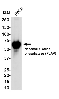 1 - Placental Alkaline Phosphatase Rabbit mAb AP75927