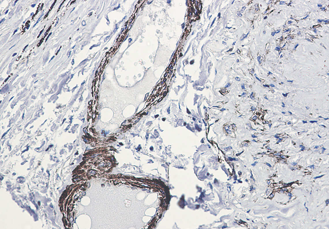 2 - Phospho-beta Arrestin 1 (Ser412) Rabbit mAb AP76326