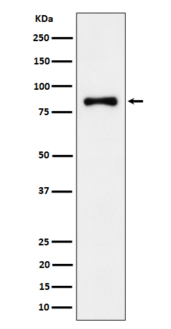 1 - ALDH16A1 Rabbit mAb AP78812